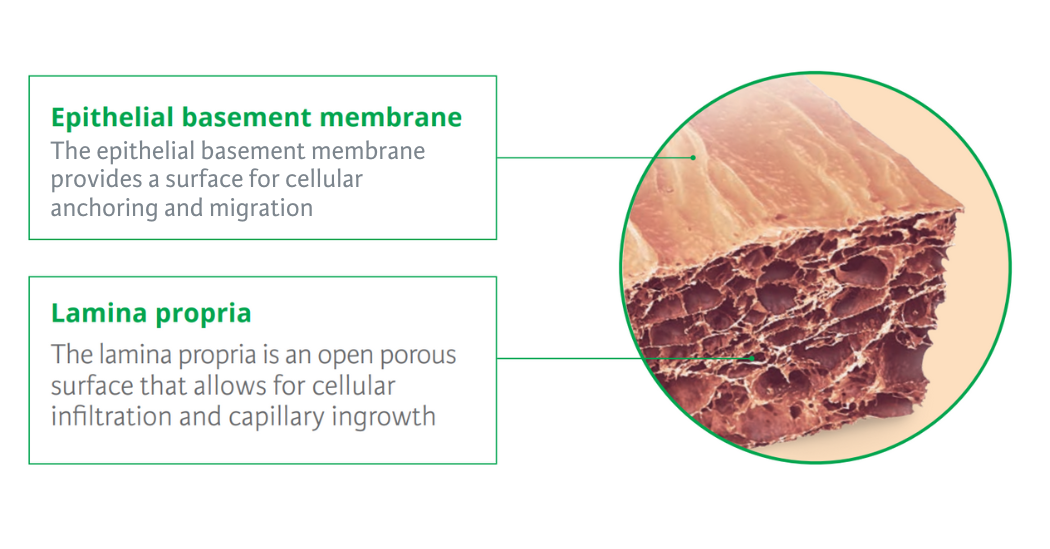 UBM provides an environment where the body is more likely to exhibit a higher ratio of M2 to M1 macrophages,3,7 which has been shown to facilitate the remodeling of site-appropriate tissue.3 (3)